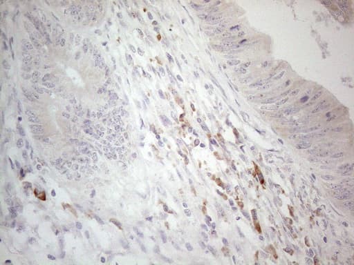 Monoclonal Mouse anti-Human CCDC36 Antibody (clone OTI2D11, IHC, WB)