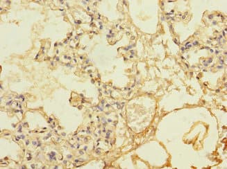 THBD / CD141 / Thrombomodulin Antibody