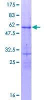 Human OVOL1 Protein (Recombinant GST)