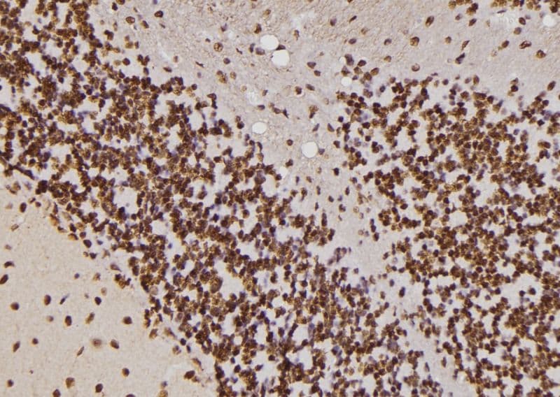 Polyclonal Rabbit anti-Human HIPK4 Antibody (IHC, IF, WB)
