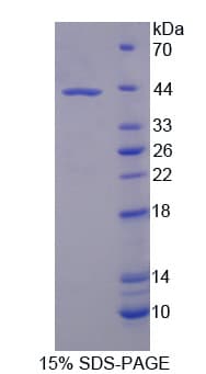 Human USP8 / UBPY Protein (Recombinant His-T7)