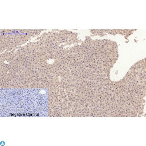 Polyclonal Rabbit anti-Human APP / Beta Amyloid Precursor Antibody (WB)
