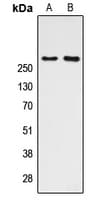 Polyclonal Rabbit anti-Human CREBBP / CREB Binding Protein Antibody (Acetyl-Lys1535, IHC, IF, WB)