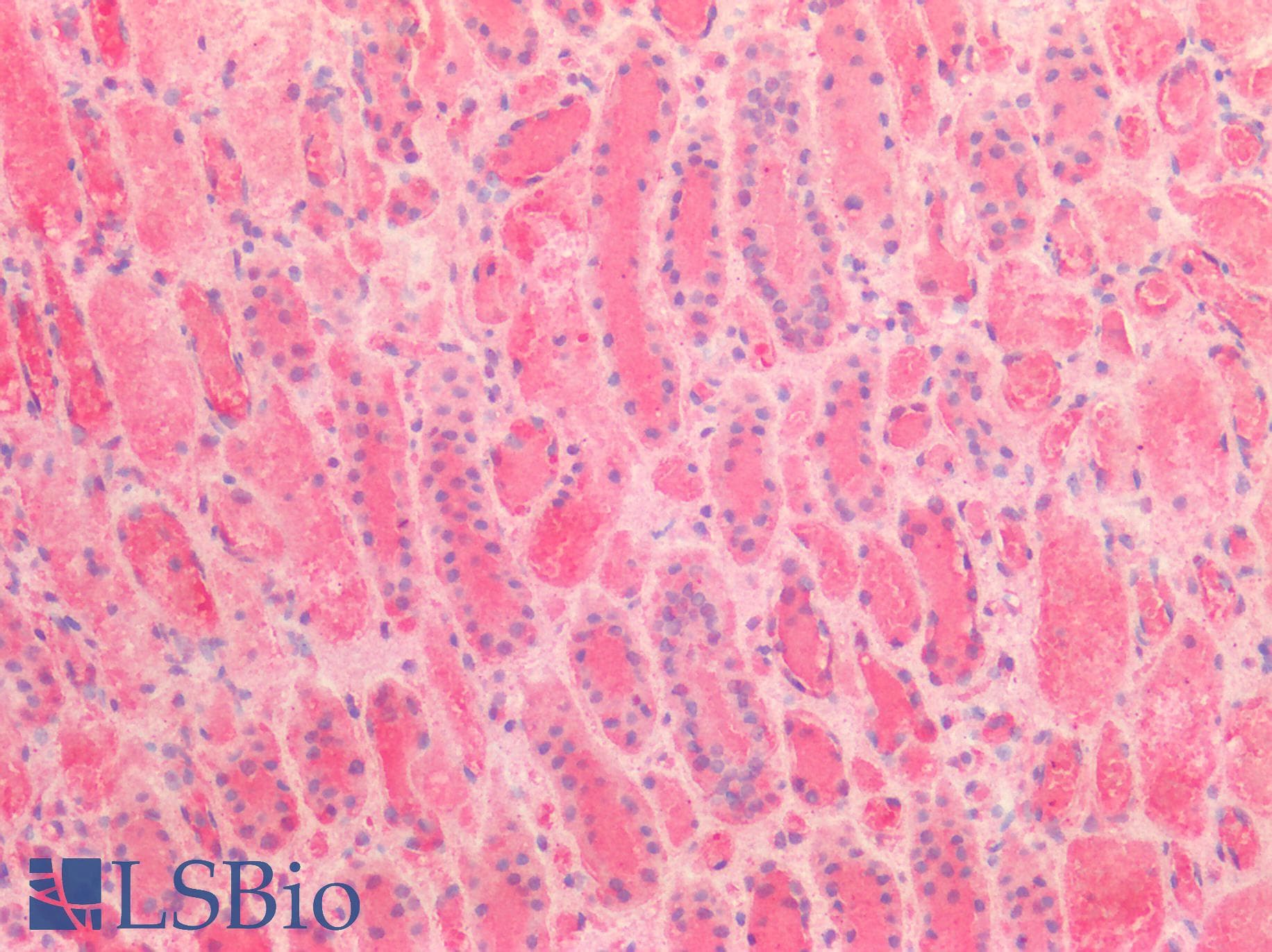 IHC-plus™ Polyclonal Rabbit anti-Human BCL2L1 / BCL-XL Antibody (aa46-66, IHC, WB)
