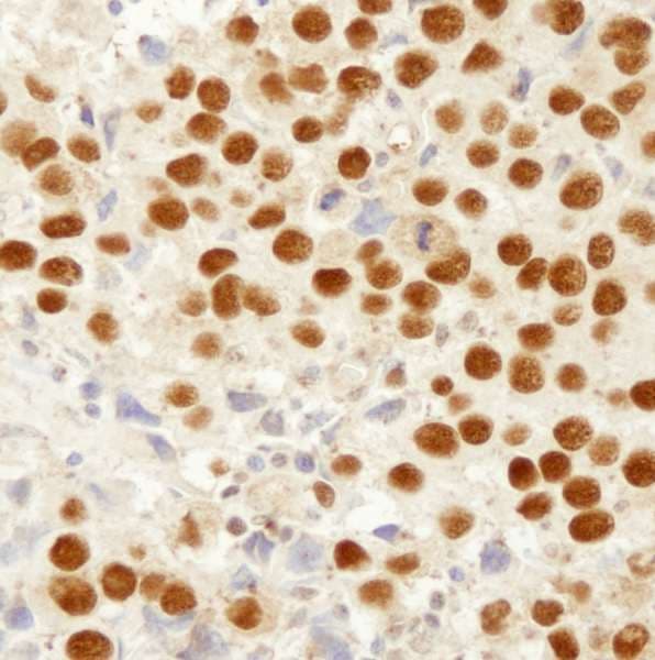 MSH2 Antibody (aa875-C-term)