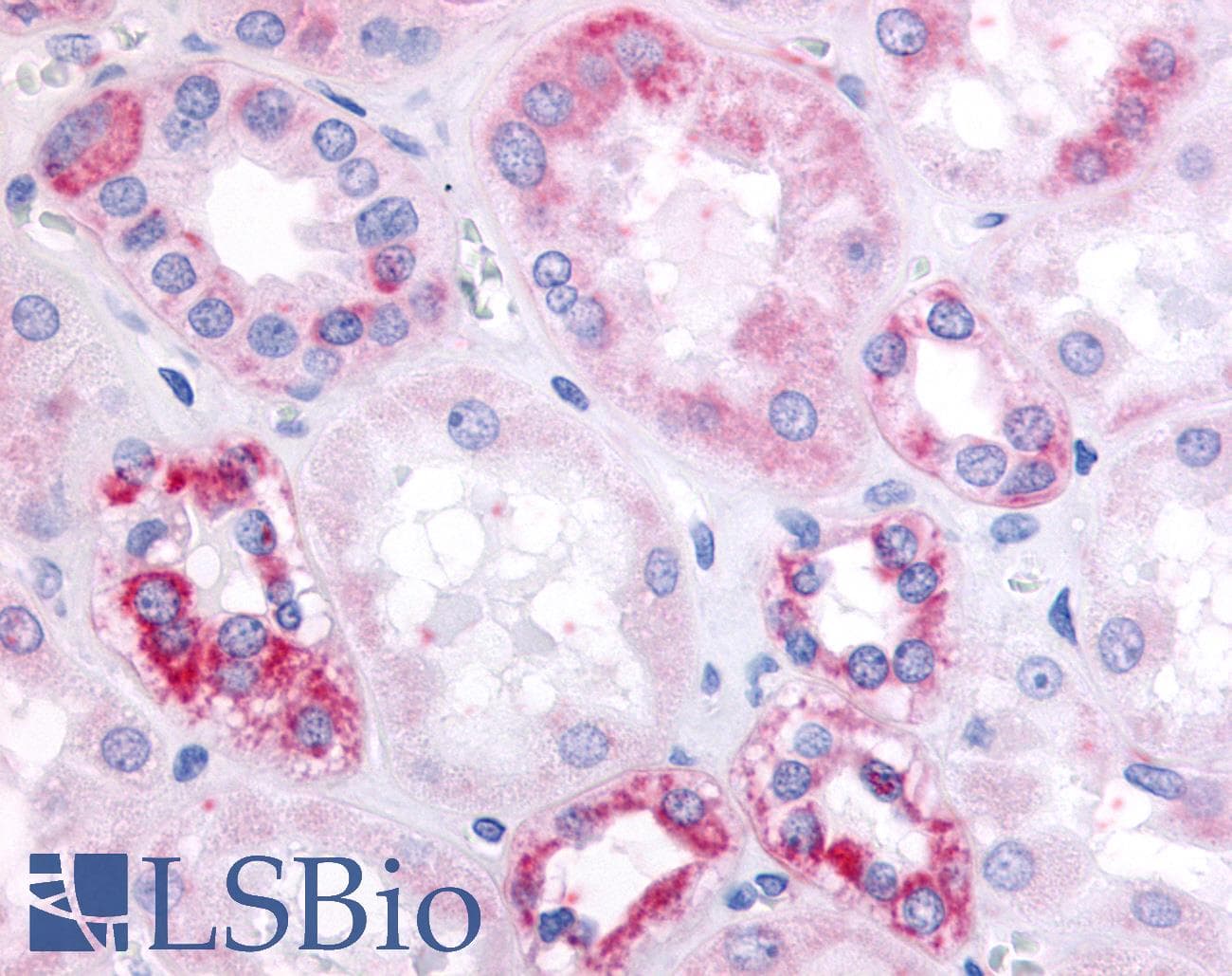 IHC-plus™ Polyclonal Rabbit anti-Human SUCNR1 / GPR91 Antibody (Cytoplasmic Domain, IHC)