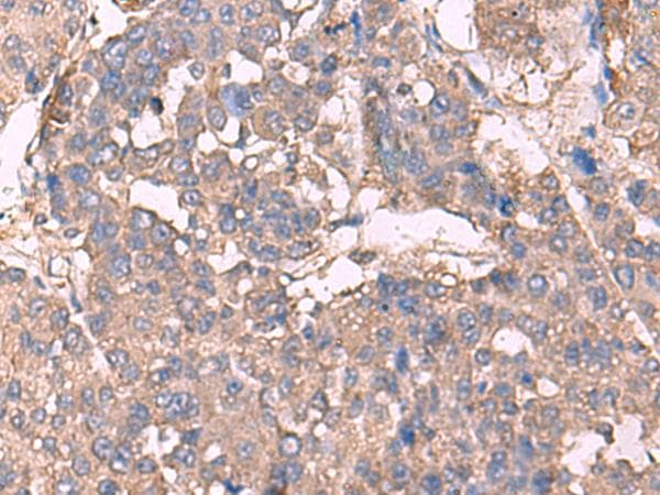 KCNN2 Antibody
