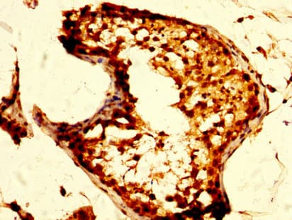 OPRM1 / Mu Opioid Receptor Antibody