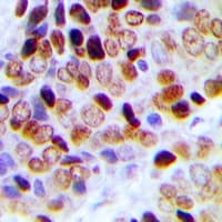 Polyclonal Rabbit anti-Human TCEAL1 Antibody (Internal, IHC, IF, WB)