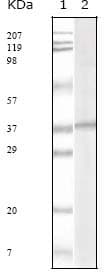 HHV-8 ORF62 Antibody (clone 5B7B6)