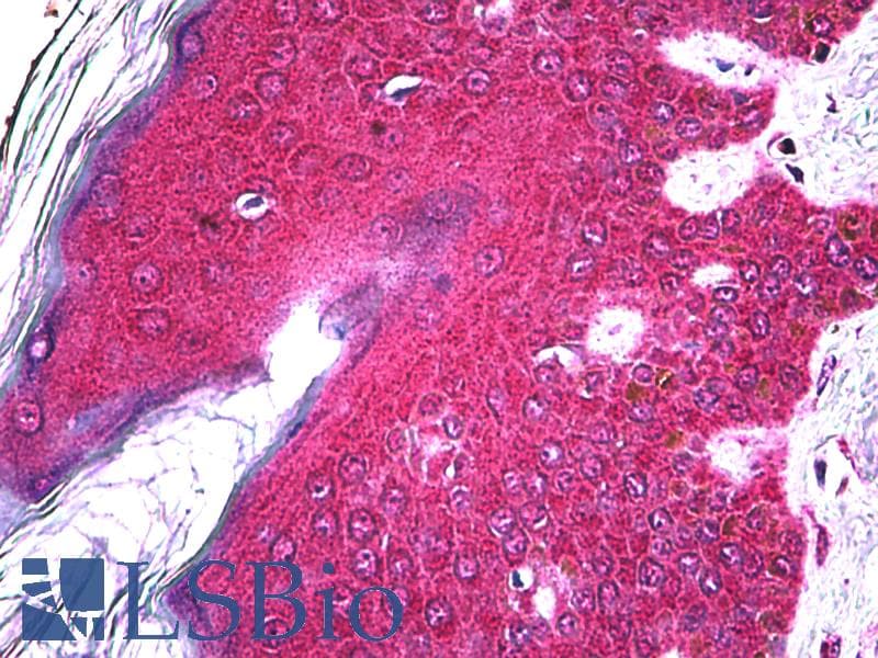 IHC-plus™ FGFR2 / FGF Receptor 2 Antibody (clone 1G3)