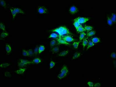 Polyclonal Rabbit anti-Human ATP6V1E2 Antibody