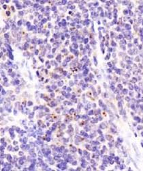 DEPTOR / DEPDC6 Antibody (aa10-200, DY488)