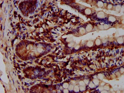 Polyclonal Rabbit anti-Human VPS52 / SACM2L Antibody (IHC)