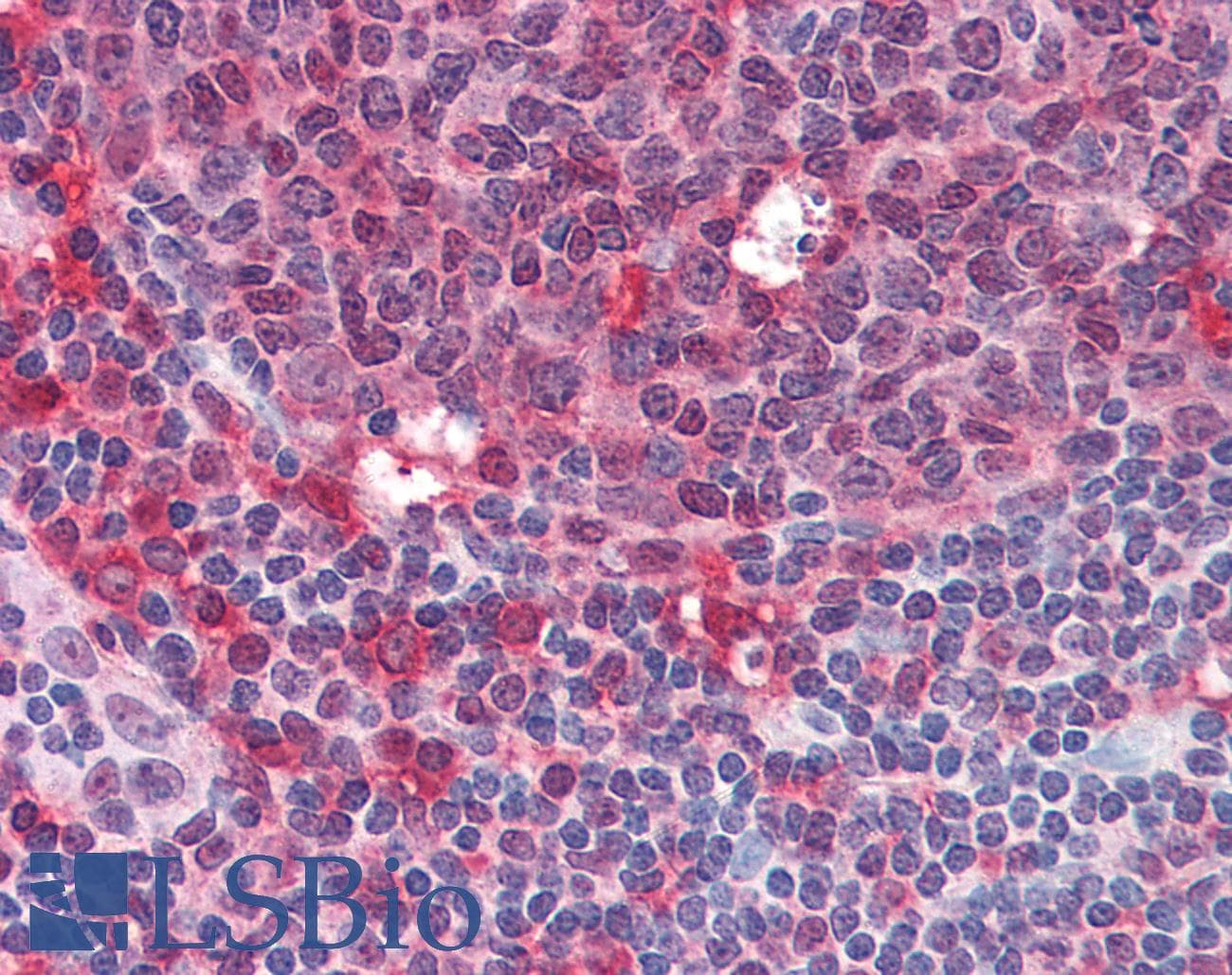 IHC-plus™ SYK Antibody (aa5-360)