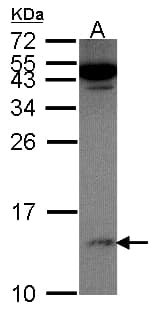 Polyclonal Rabbit anti-Human Calgizzarin / S100A11 Antibody (aa8-102, IHC, WB)