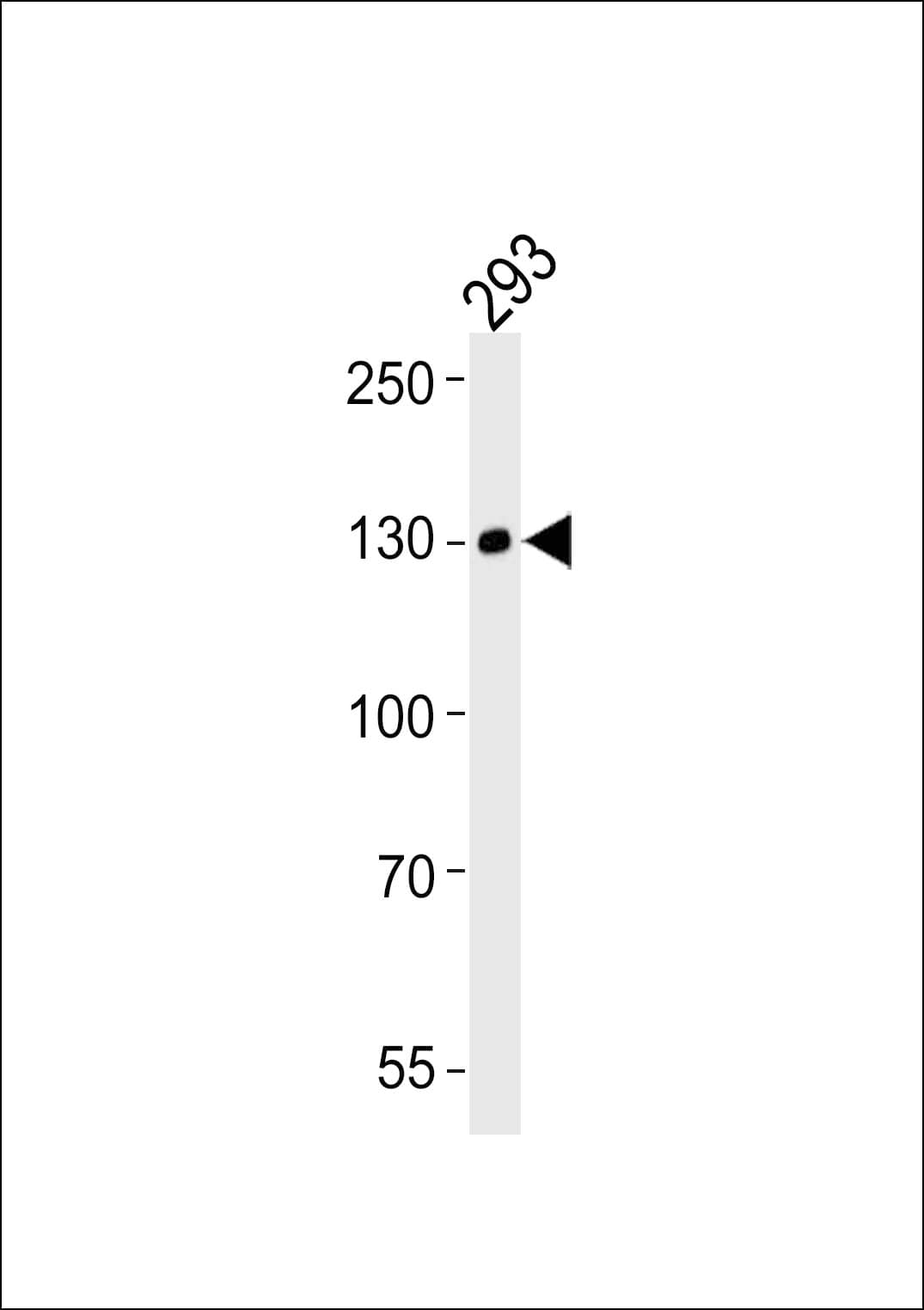 EPHA6 / EPH Receptor A6 Antibody (clone 1426CT591.205.91.119)