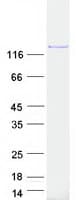 Human PFAS Protein (Recombinant Myc-DDK (Flag))