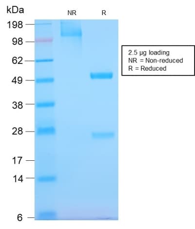 EGFR Antibody (clone GFR/2968R, Azide-free, Carrier-free)