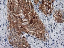 SERPINB4 / SCCA1+2 Antibody (clone OTI4C8)