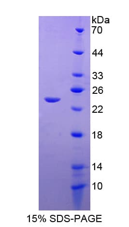 Human SERPINB4 / SCCA1+2 Protein (Recombinant His-T7)