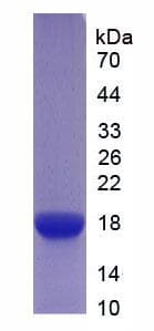 Mouse IL6R / IL6 Receptor Protein (Native His, N-Terminal)