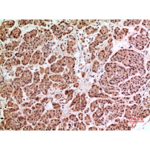 Polyclonal Rabbit anti-Human HPSE / Heparanase Antibody (241-290 aa, Internal, IHC, WB)