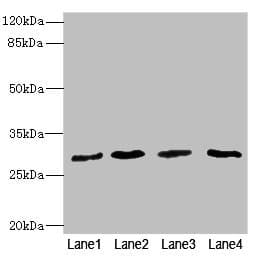 RCHY1 / PIRH2 Antibody