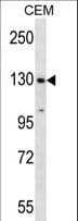 Polyclonal Rabbit anti-Human SF3B1 Antibody (aa374-402, IHC, WB)