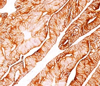 Monoclonal Mouse anti-Human KRT8 / CK8 / Cytokeratin 8 Antibody (clone H1, Ready-to-Use, IHC, IF, WB)