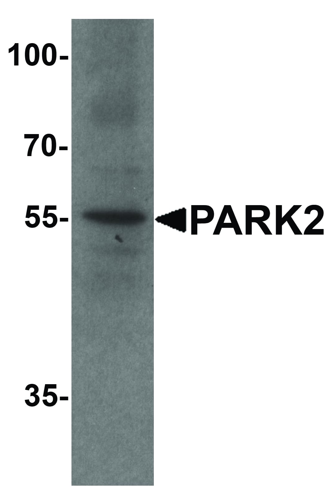 PARK2 / Parkin 2 Antibody