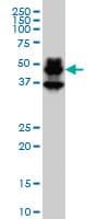 Monoclonal Mouse anti-Human PBX1 Antibody (clone 4A2, IHC, IF, WB)