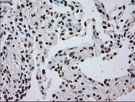 TYRO3 Antibody (clone OTI5B4)