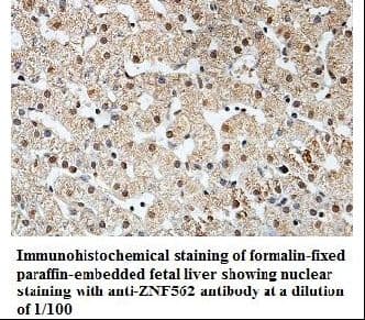 Polyclonal Rabbit anti-Human ZNF562 Antibody (aa152-414, IHC, WB)