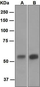 IHC-plus™ CA9 / Carbonic Anhydrase IX Antibody (Extracellular Domain, clone EPR4151(2))