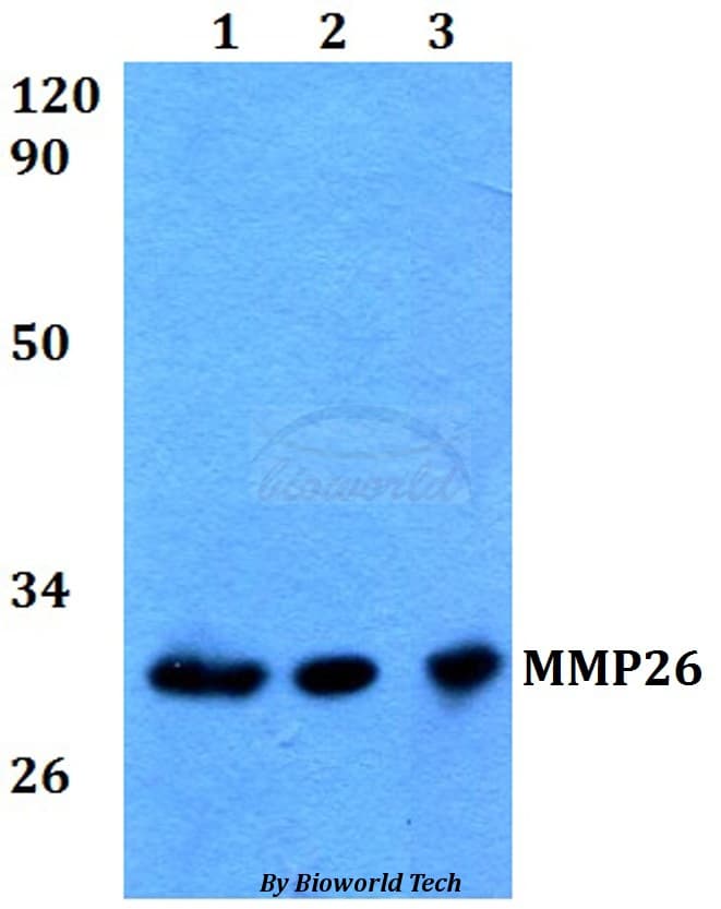 Polyclonal Rabbit anti-Human MMP26 Antibody (WB)