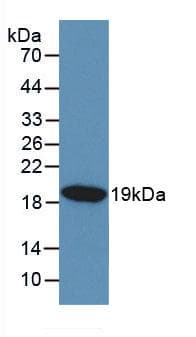 KISS1 / Kisspeptin / Metastin Antibody (APC, Cy7)