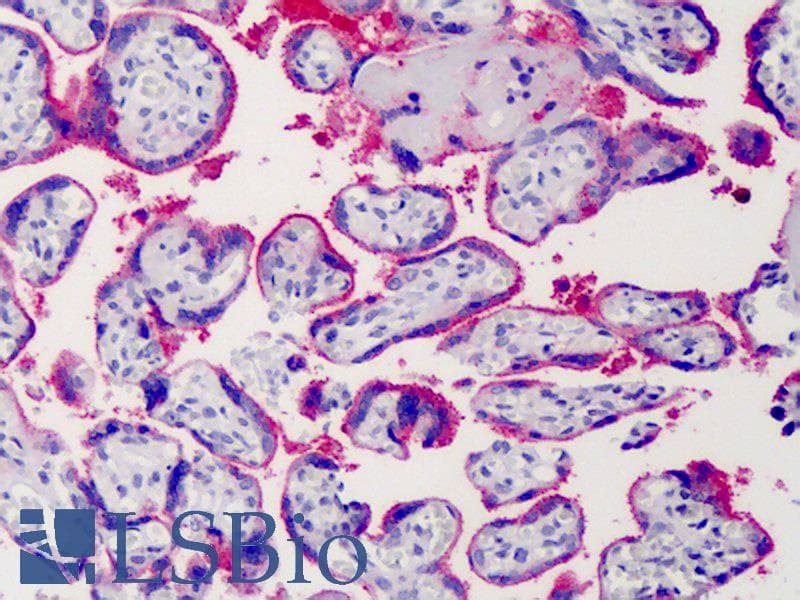 IHC-plus™ SDC1 / Syndecan 1 / CD138 Antibody