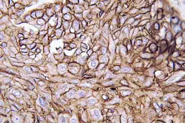 Polyclonal Rabbit anti-Human AQP3 / Aquaporin 3 Antibody (Val214, IHC)