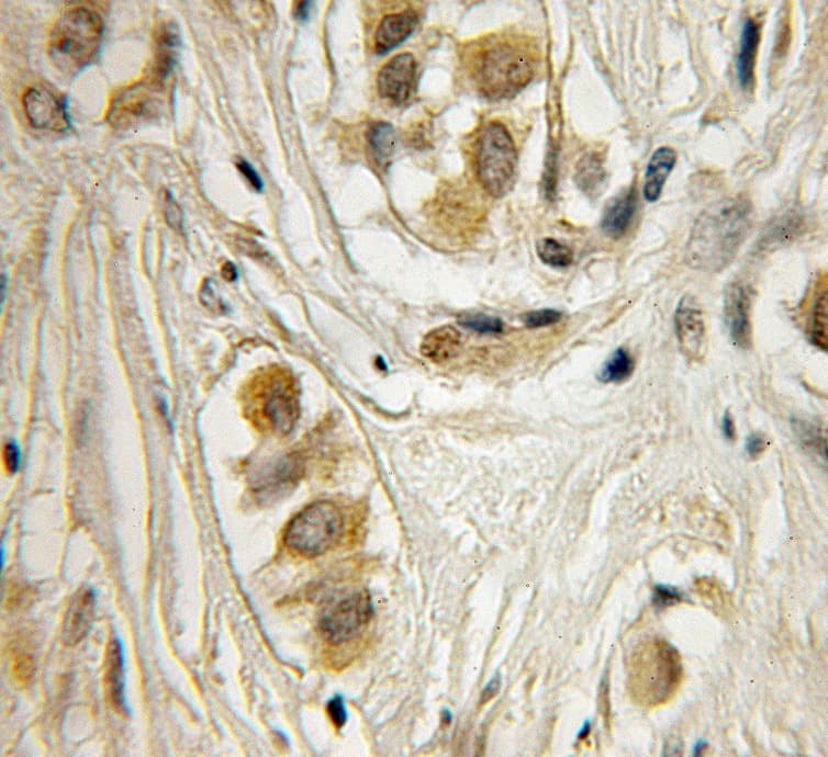 APP / Beta Amyloid Precursor Antibody