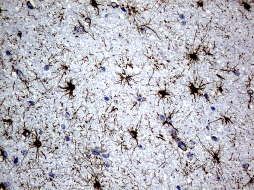 GFAP Antibody (clone UMAB129, Carrier-free)