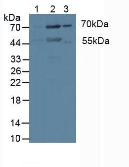 PRKCI / PKC Iota Antibody (aa375-596, APC)