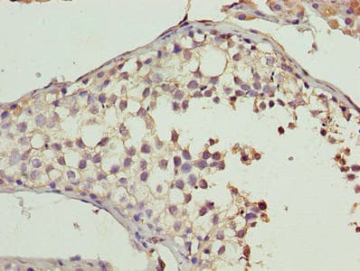 Polyclonal Rabbit anti-Human CYB5R2 Antibody (IHC, WB)