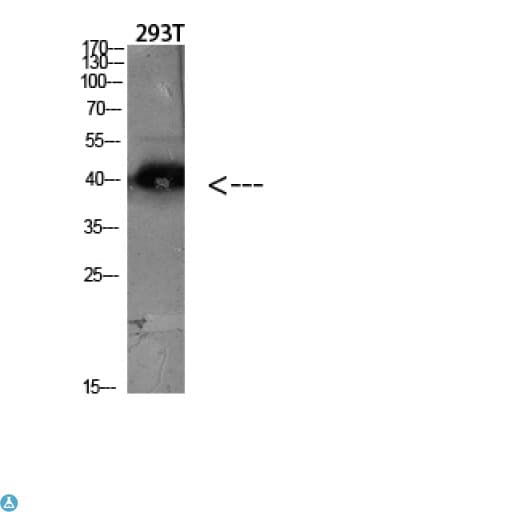 CCR5 Antibody