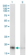 RPL23A Antibody (clone 3E11)