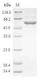 Human RPS27 / Ribosomal Protein S27 (Recombinant GST, N-terminus)