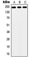 ZNF638 Antibody (Internal)