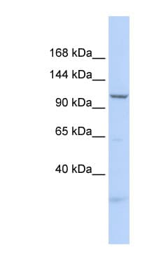 SKIV2L2 Antibody (aa35-84)