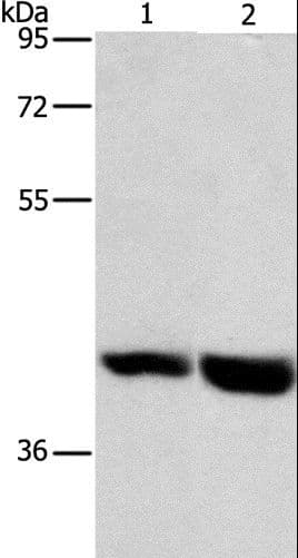 GPR182 / ADMR Antibody