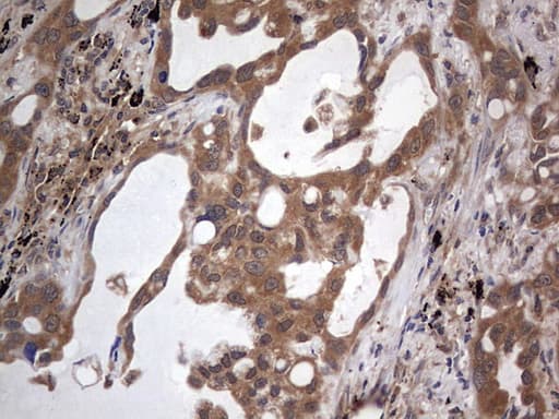 Monoclonal Mouse anti-Human ARAF / ARAF1 / A-RAF Antibody (clone OTI2G9, aa145-365, IHC, WB)